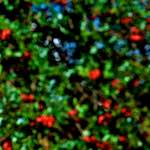 image: Image from the photoset &lsquo;parc (v)&rsquo;.