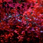 image: Image from the photoset &lsquo;parc (v)&rsquo;.