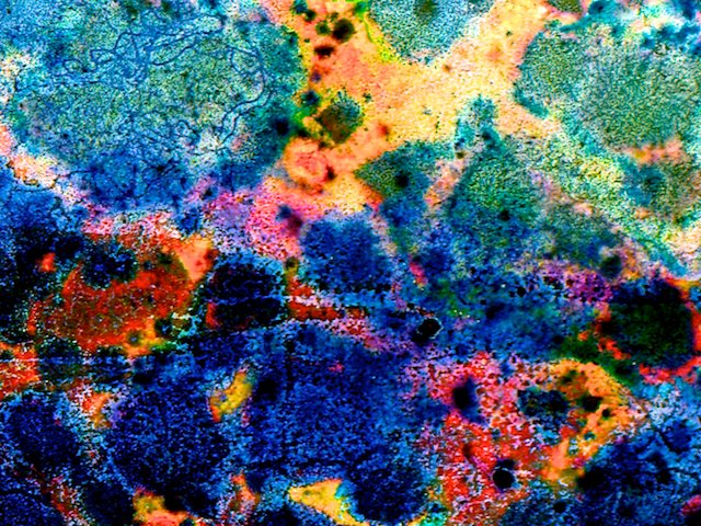 image: unlabelled image