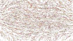 Eighth of 'reflets &mdash; paint synthesiser classic &mdash; 3.0 collection frothy 5'.