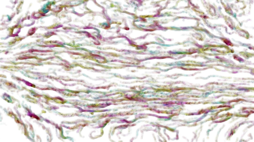 Image 'reflets &mdash; paint synthesiser classic &mdash; default sketch effects 1 3 5'.