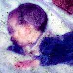 image: Image from the photoset &lsquo;damage (xvi)&rsquo;.