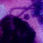 Seventh image from the photoset 'damage (v)'.