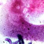 image: Image from the photoset &lsquo;damage (vi)&rsquo;.