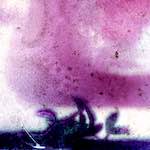 image: Image from the photoset &lsquo;damage (vi)&rsquo;.