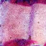 image: Image from the photoset &lsquo;damage (xiv)&rsquo;.