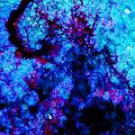 image: Image from the photoset &lsquo;damage (liv)&rsquo;.