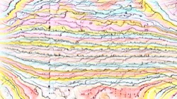 image: image from head abstraction